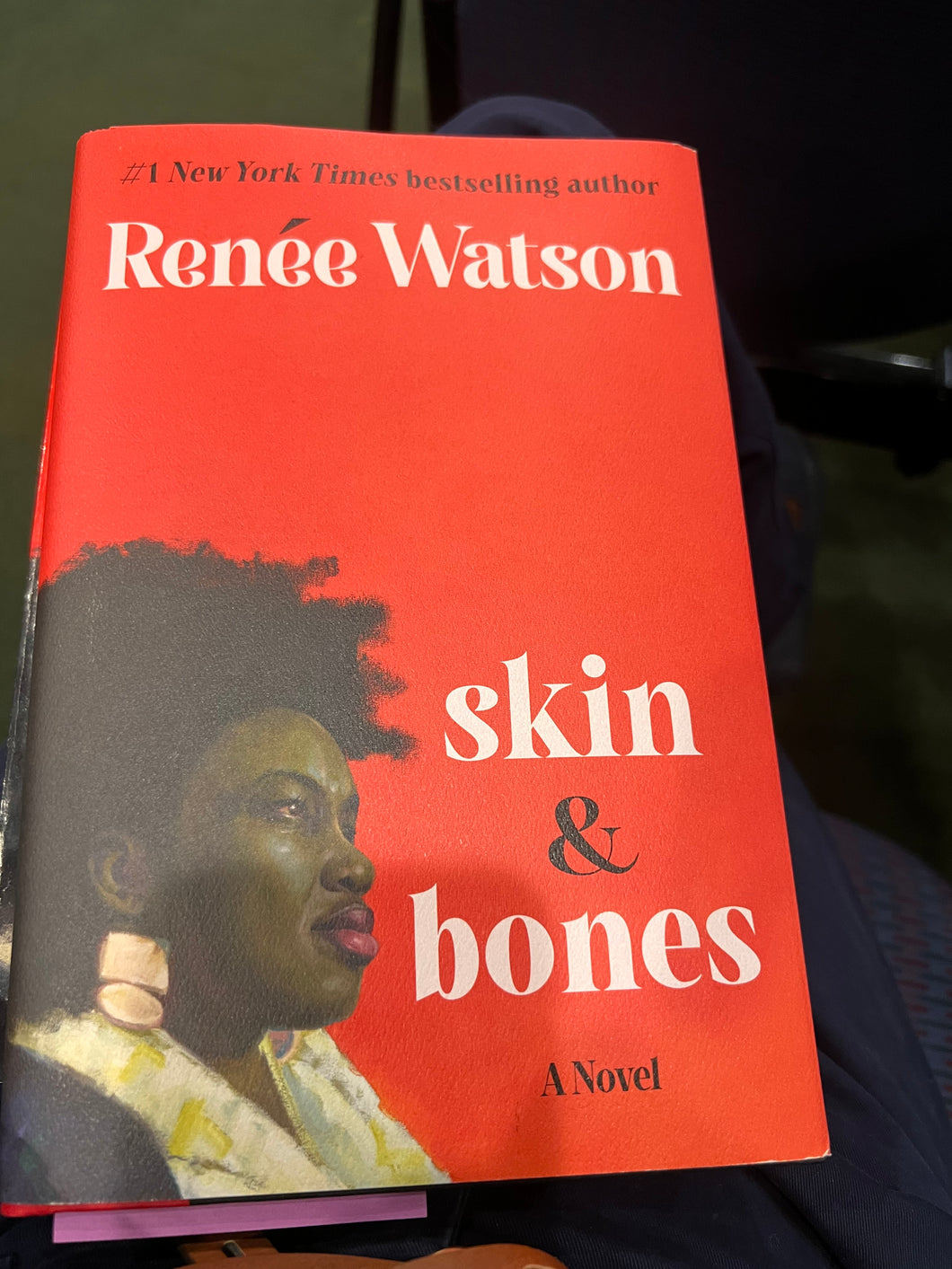skin & bones
a novel | Reneè Watson